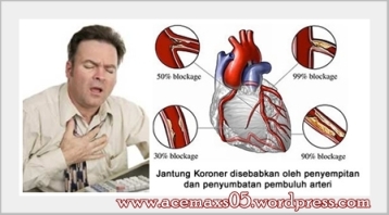 Obat tradisional jantung kroroner